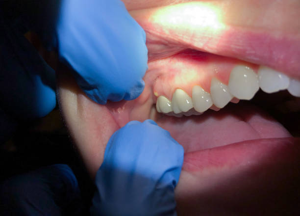 Best Walk-In Emergency Dentist in Red Bank, SC